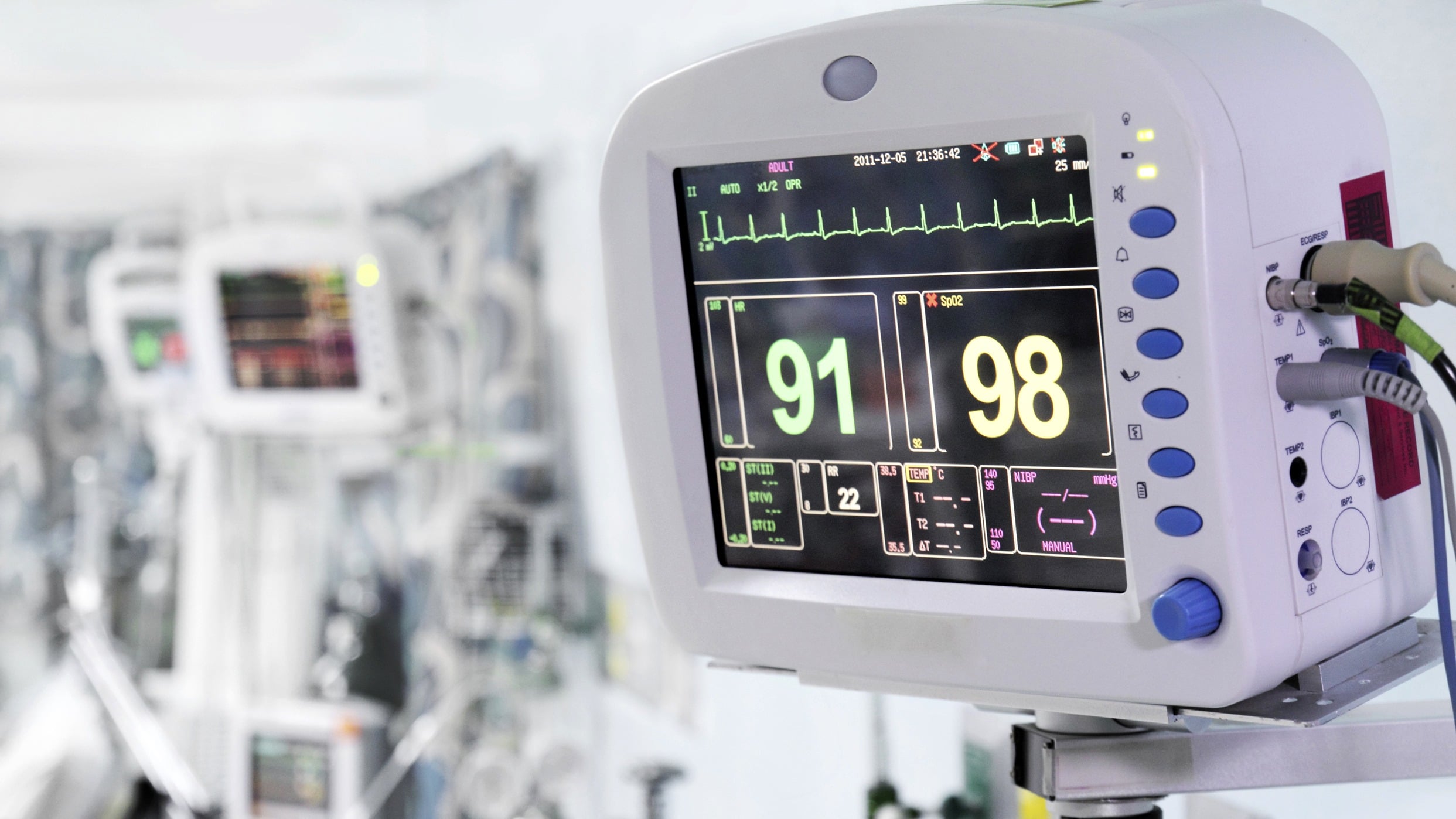 Medical device monitor displaying patient vital signs, representing quality management and compliance in healthcare technology.